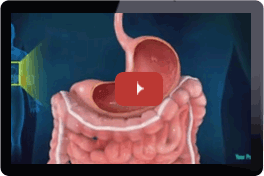 Multimedia Patient Education Videos